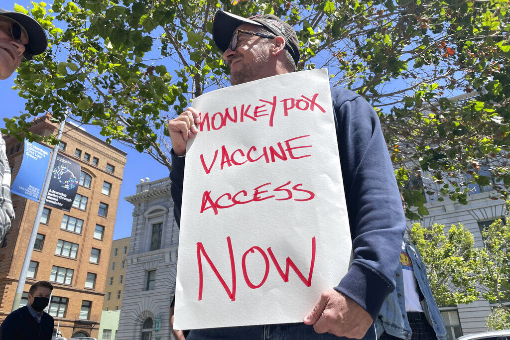 Monkeypox-California